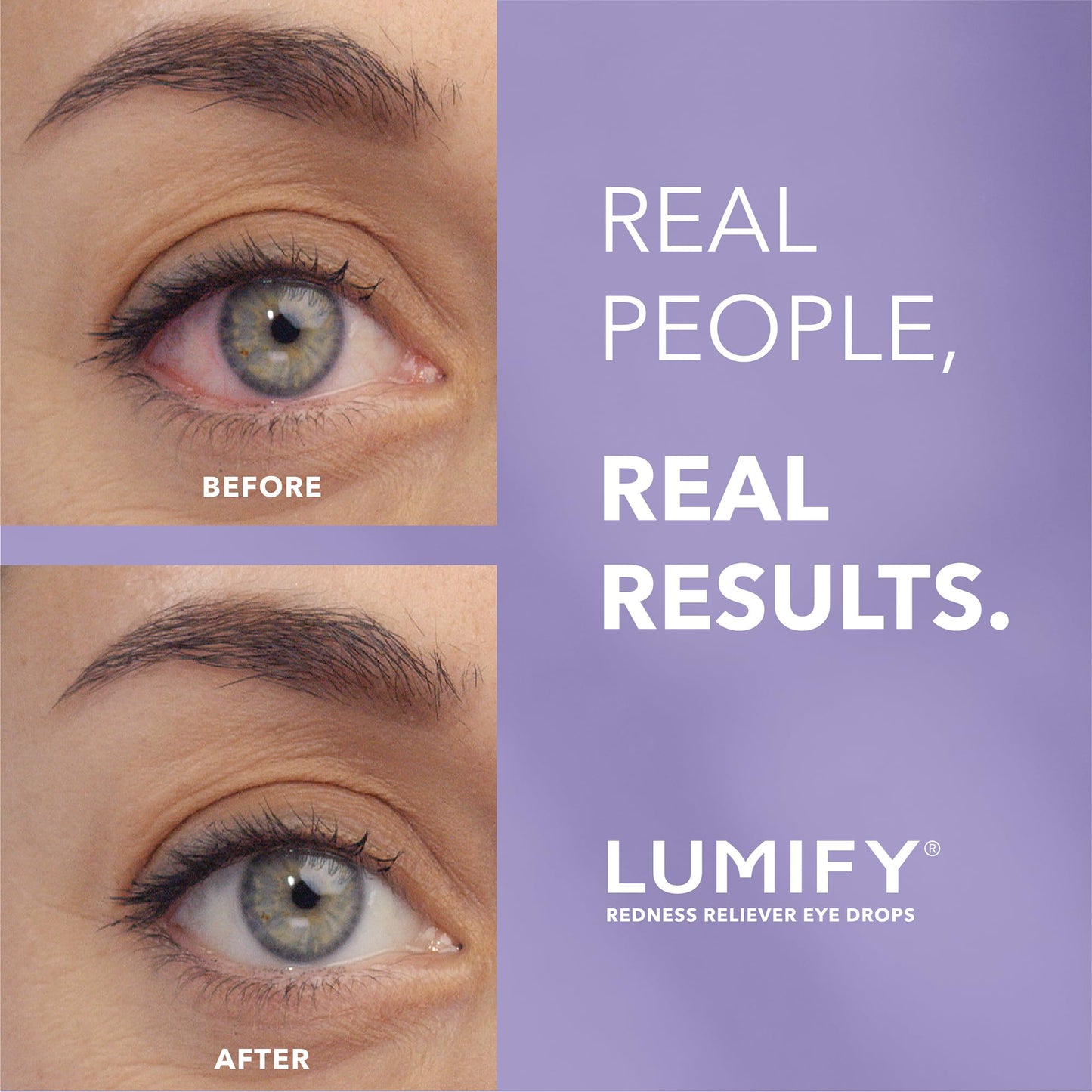 LUMIFY Eye Drops for Red Eyes, Redness Reliever for Brighter Looking Eyes, Works in 1 Minute & Lasts Up to 8 Hours, Eye Drops, 0.17 Fl Oz (5 mL) LUMIFY buy supplements Au