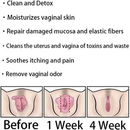 Natural Repair Vagianal Capsules, Anniecare Instant Anti-Itch Detox Slimming Products GDSAFSBuy Supplements Australia