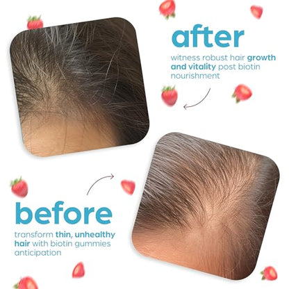Artnaturals Biotin Gummies for Hair Growth - (100 Gummies - 10000mcg) - Natural Strawberry ArtnaturalsBuy Supplements Australia