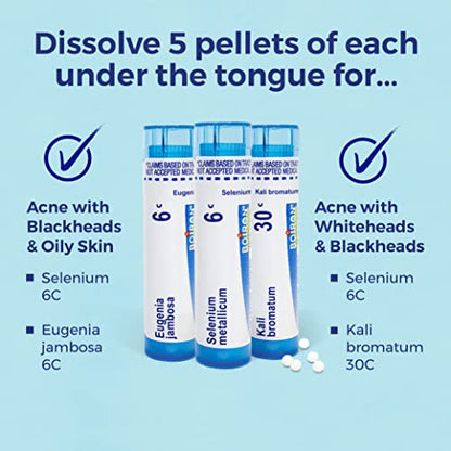 Boiron Acne Relief Kit for Blackheads, Oily Skins, Whiteheads on The Face and Body - 3 Count (240 Pellets) BoironBuy Supplements Australia