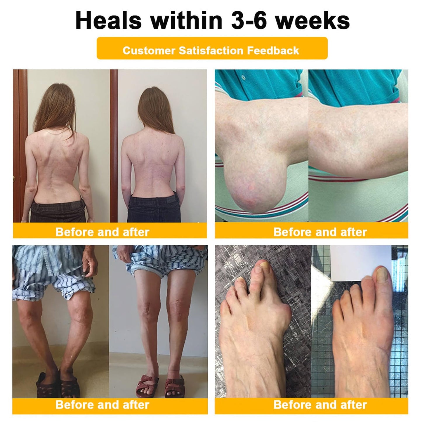 Luhaka Botulinum Toxin & Bee Venom Pain-Relief Bone Healing Cream,Bee Venom Cream,Effectively improve joint mobility (1PC) LuhakaBuy Supplements Australia