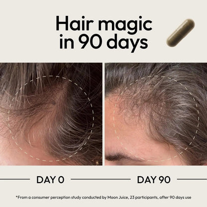 Moon Juice SuperHair Hair Growth Vitamins for Women & Men with Biotin & Saw Palmetto - Clinical Strength Multivitamin Hair Supplement Moon Juice