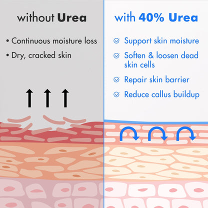 Ebanel Urea Cream 40% plus Salicylic Acid 2%, Foot Cream for Dry Cracked Heels Feet Knees Elbows Hands, Foot Dead Skin Cuticle Callus Remover Toenail Softener, Keratolytic Skin Barrier Repair, 3-Pack - Maple Wellness Supplements