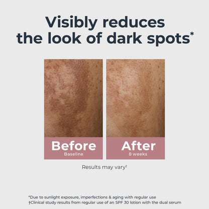 Eucerin Radiant Tone Dual Serum Dark Spot Corrector, Dark Spot Serum with Thiamidol - Maple Wellness Supplements