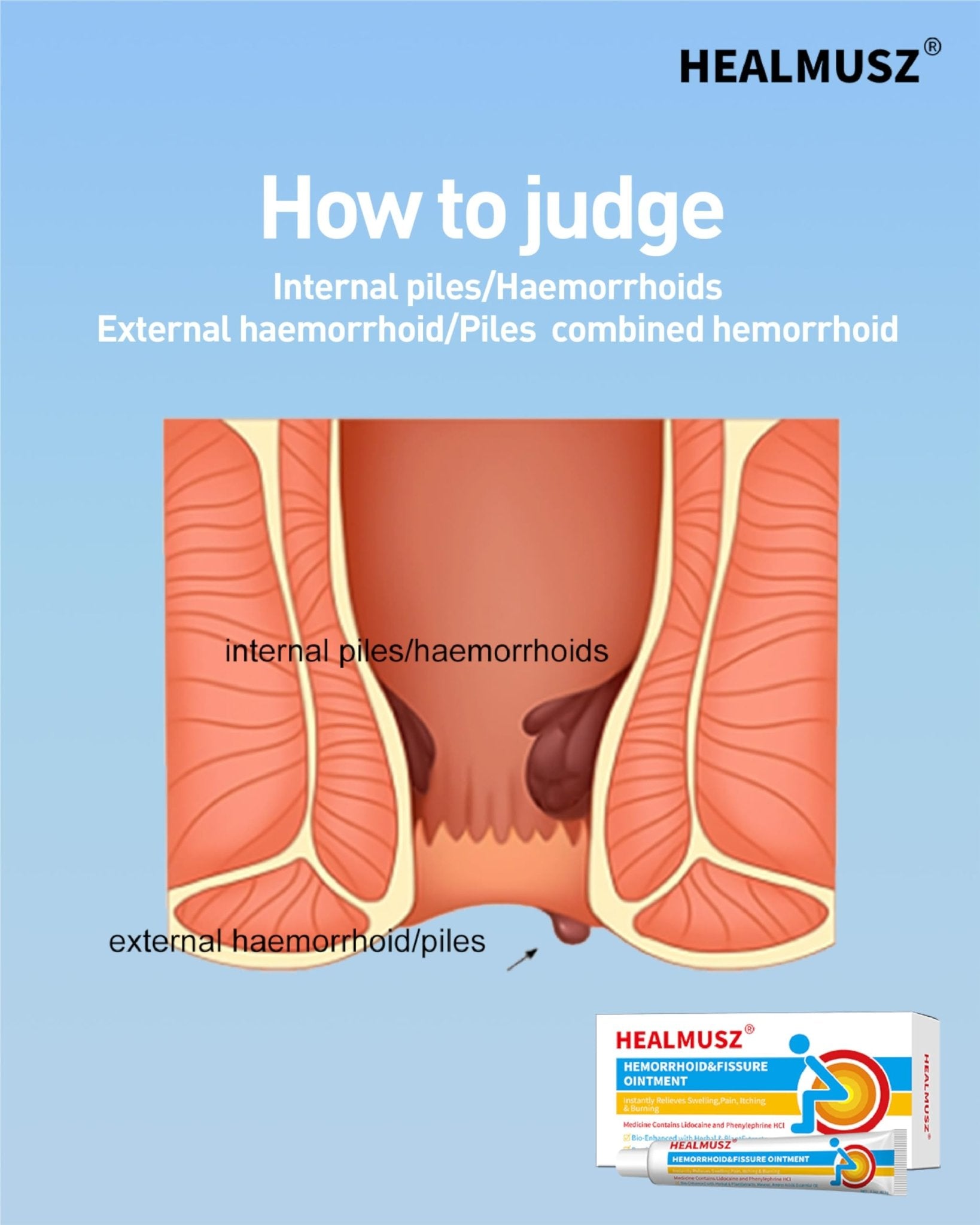 HEALMUSZ Hemorrhoid Fissure Ointment– Hemorrhoid Treatment and Hemorrhoid Cream with Lidocaine and Phenylephrine HCI for Fast Acting Relief of Pain, Swelling, Discomfort, and Itching(1.5 oz) - Maple Wellness Supplements