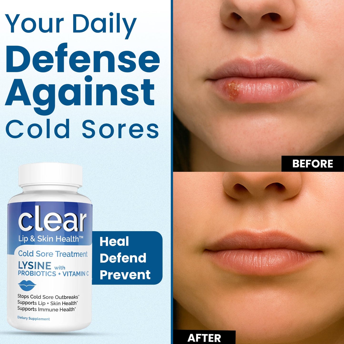 Lysine Cold Sore Treatment for Lips with Pre-Probiotics & VIT C | 1 Month Supply | Supercharged Lysine Capsules with Rhamnosus & Acidophilus for Cold Sores Relief - Maple Wellness Supplements
