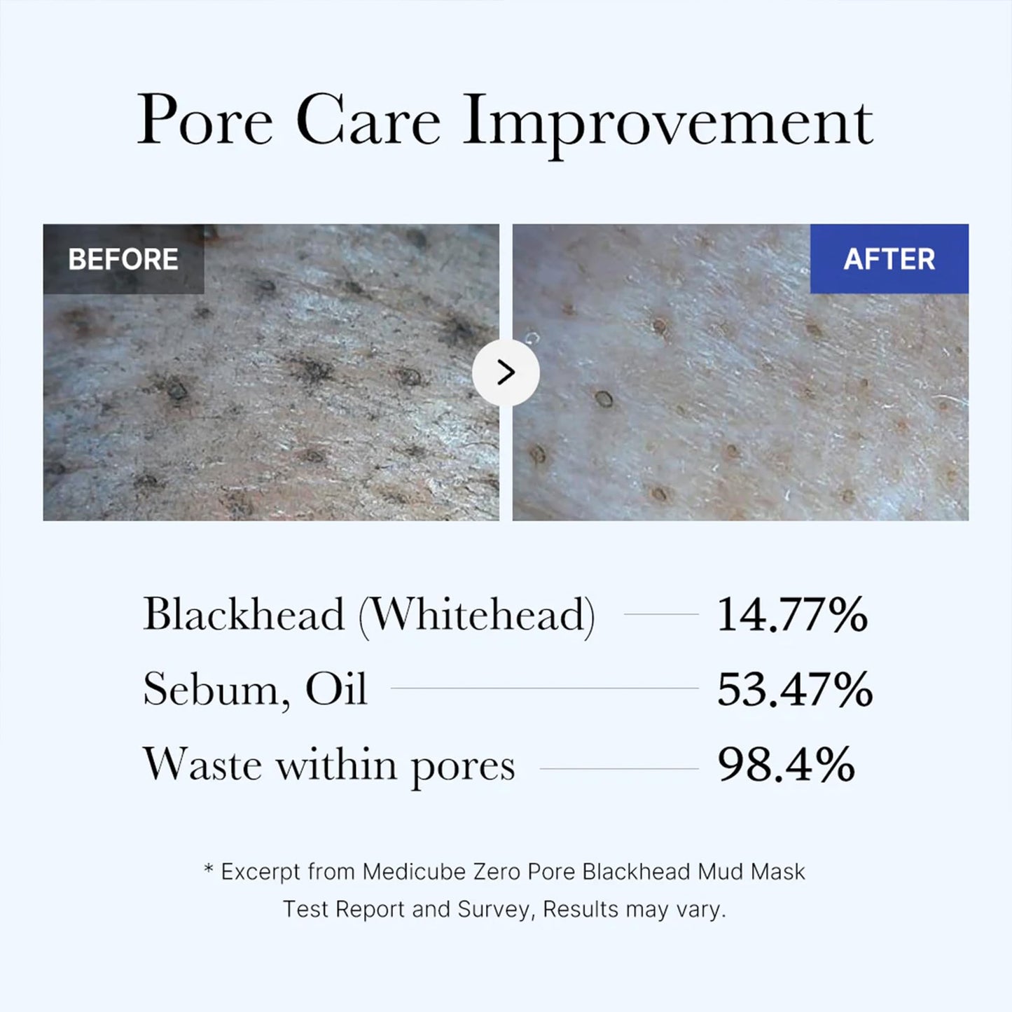 Medicube Zero Pore Blackhead Mud Facial Mask - Skin Cooling & Pore Tightening - 3 Minute Quick Dry Formula with AHA, BHA, PHA - Maple Wellness Supplements
