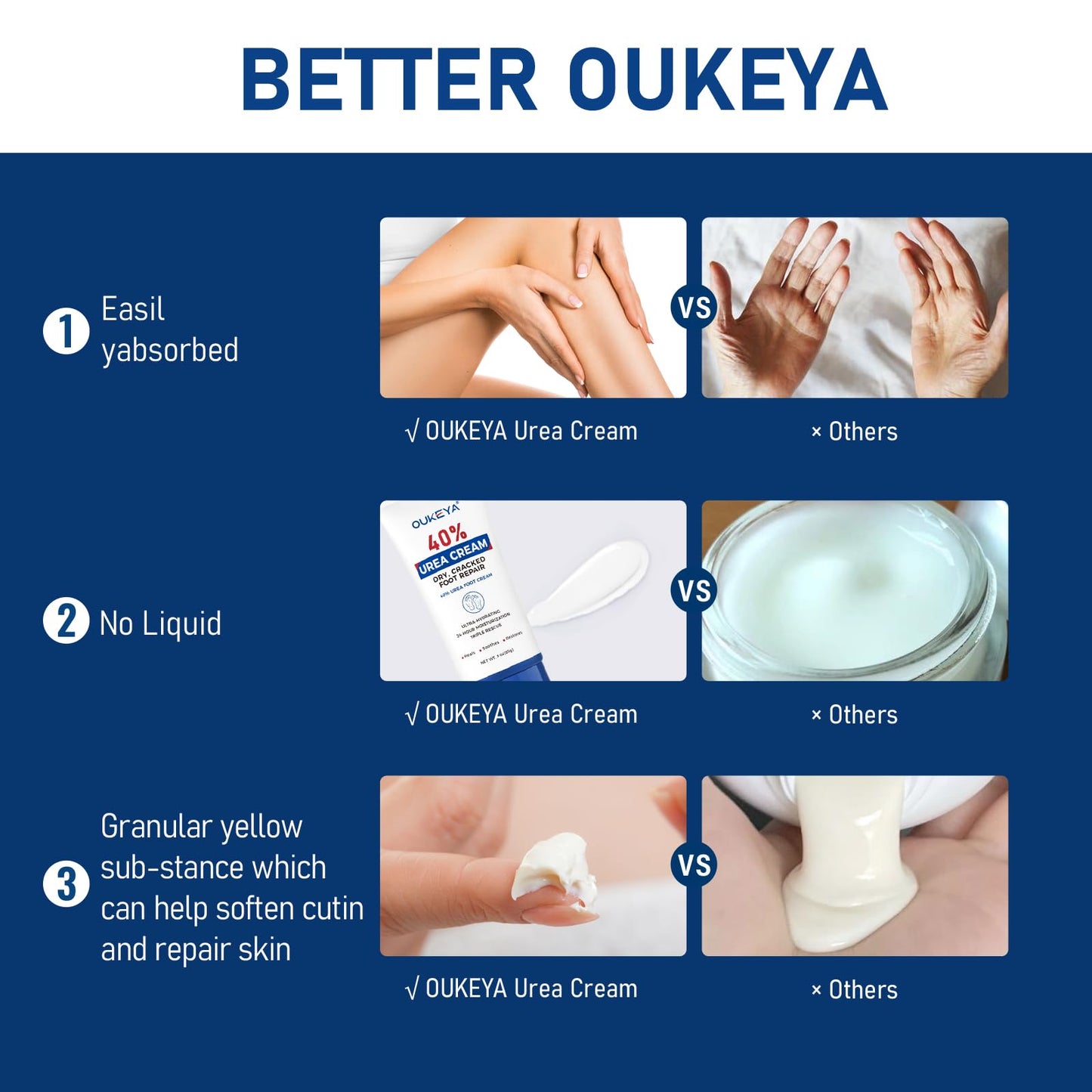 OUKEYA Urea Cream 40 Percent Tube 3 Oz, Foot & Hand Cream for Dry Cracked, 40 per Urea Lotion for Feet Maximum Strength - Maple Wellness Supplements