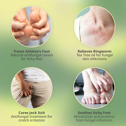 PURPLE CANYON Anti Fungal Balm with 15% Undecylenic Acid – Antifungal for Athletes Foot, Jock Itch & Ringworm – Tea Tree, Menthol & Essential Oils - Maple Wellness Supplements
