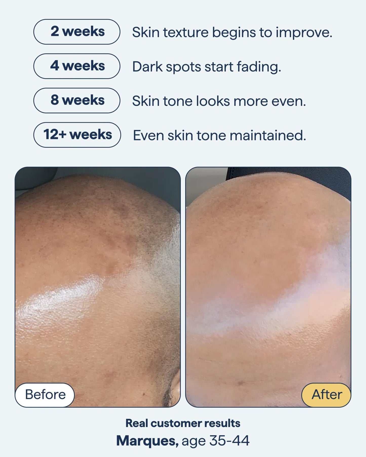 Remedy for Dark Spots | Advanced Night Treatment with Retinol & Kojic Acid | For Discoloration and Uneven Tones | With Glutathione - Maple Wellness Supplements