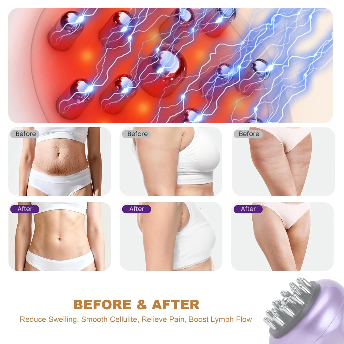 SHANOER 4-in-1 Lymphatic Drainage Massager - Anti Cellulite Massage Tool with Heating/Vibration/Red Light/Microcurrent,Body Sculpting Machine for Legs/Belly/Back/Hips/Reduce Stretch Marks & Cellulite - Maple Wellness Supplements