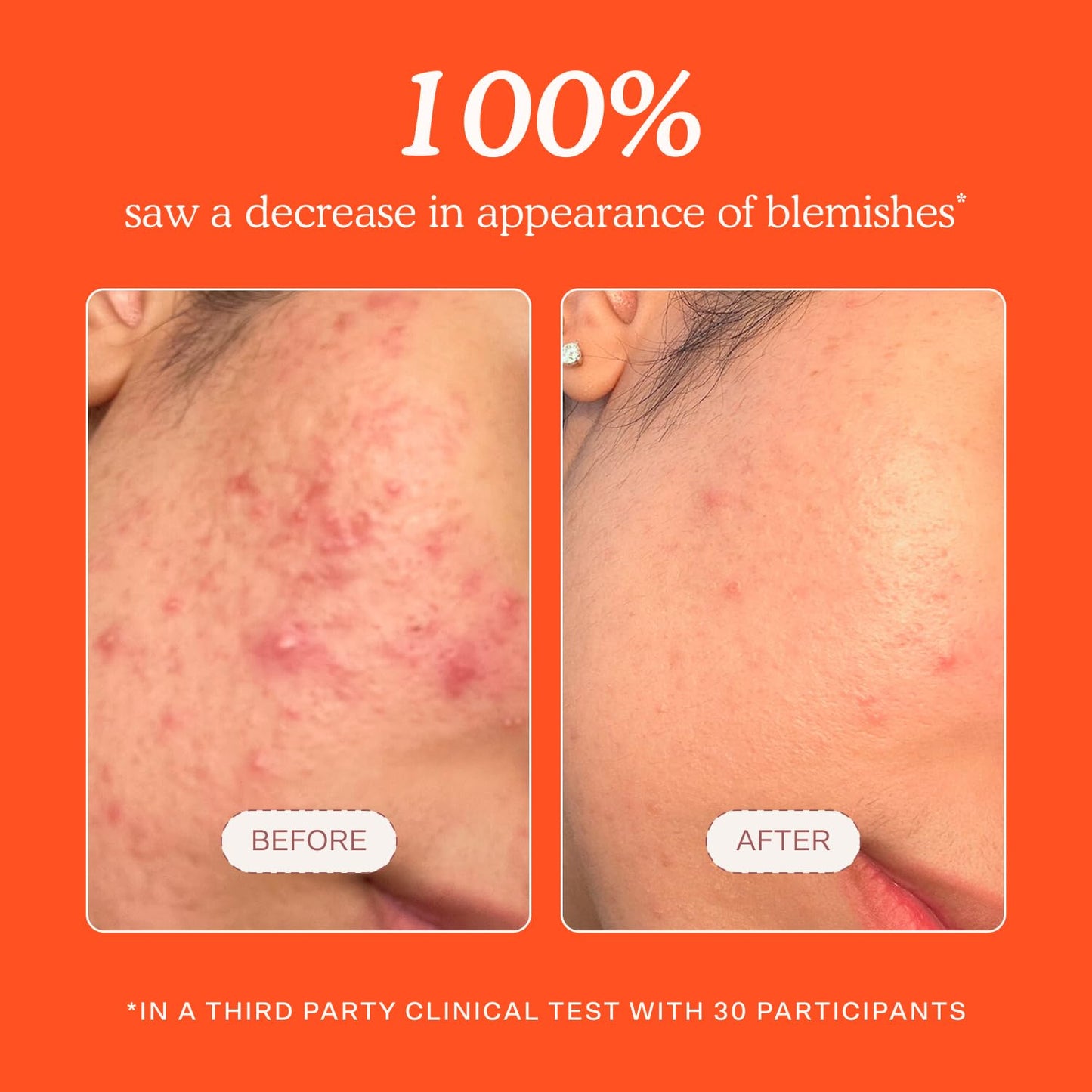Tower 28 SOS Daily Rescue Facial Spray - Hypochlorous Acid Spray to Help Reduce Redness, Calm Irritation + Alleviate Flare-Ups - Soothing + Purifying Face Toner - Everyday Skin Care Essential (4 oz) - Maple Wellness Supplements
