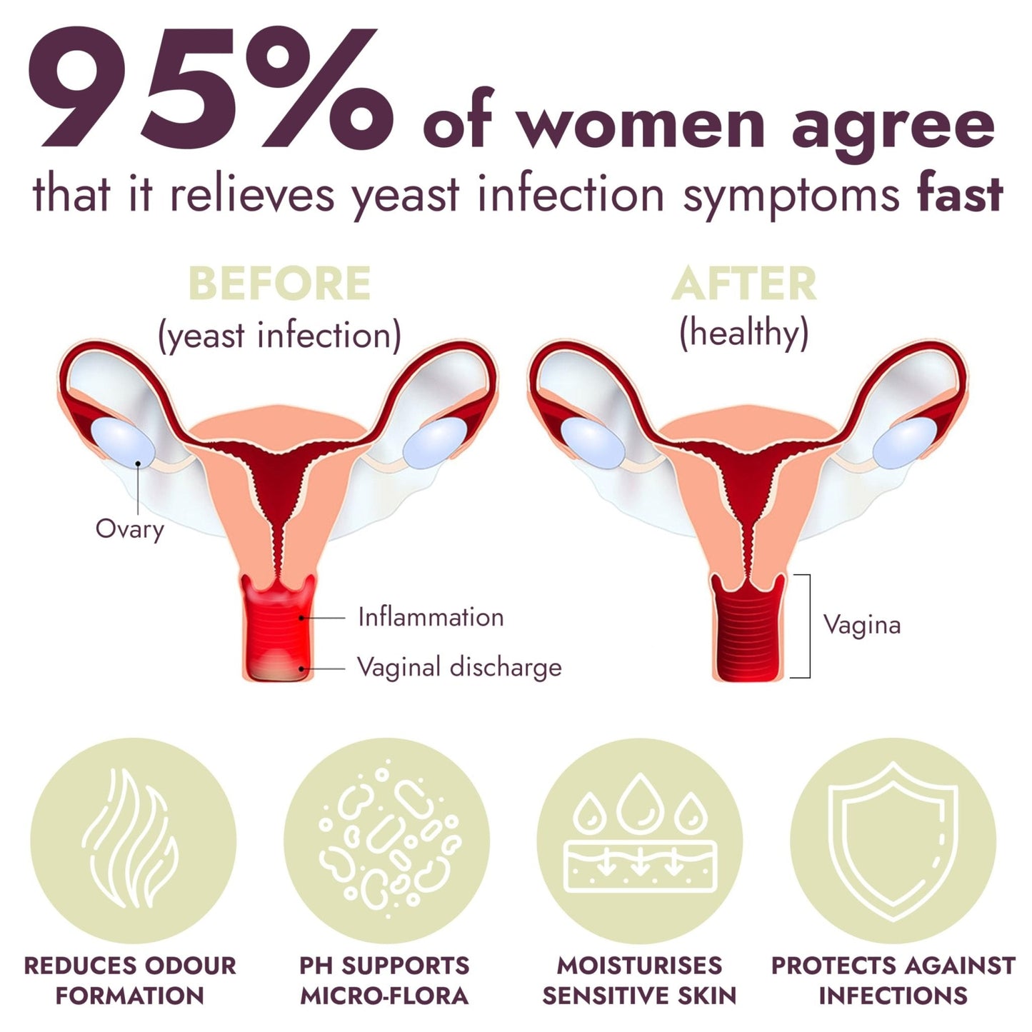 Yeast Infection Treatment for Women | Boric Acid Suppositories For Women | Helps Relieve Itching & Irritation | Vaginal Aid for Inflammation, Dryness & Watery Discharge | 12 Vaginal Suppositories - Maple Wellness Supplements
